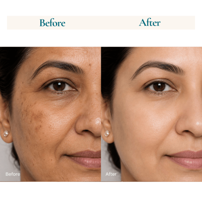 5% Niacinamide Face Serum with Hylauronic Acid , Lactic Acid & Vitamin E l 30ml - Image 3
