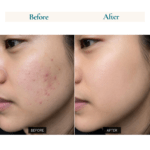 AHA + BHA Gel Face Wash (100 ML) - Image 3