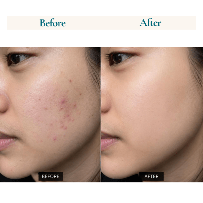 AHA + BHA Gel Face Wash (100 ML) - Image 3